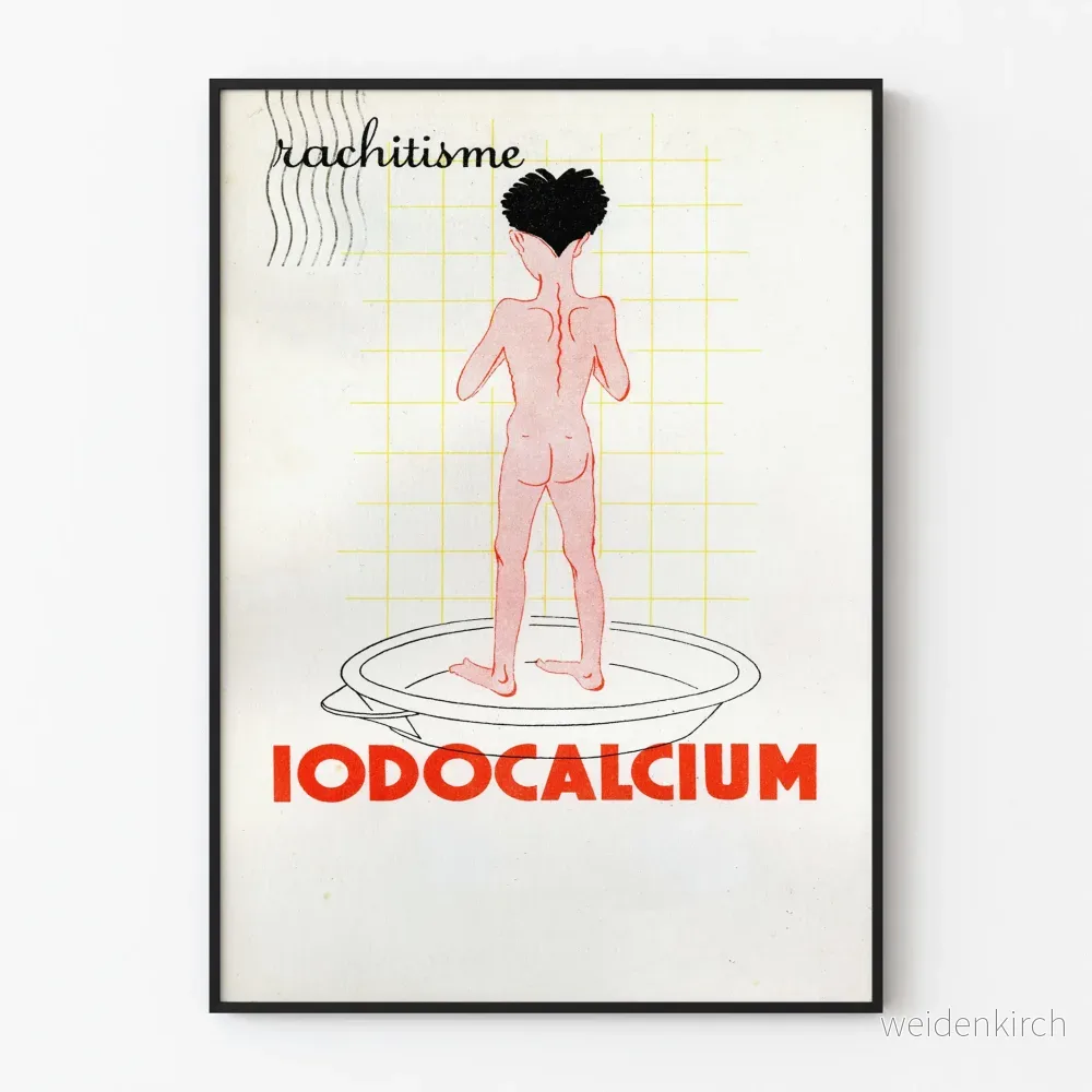 Vintage medicinsk poster om raketism och Iodocalcium